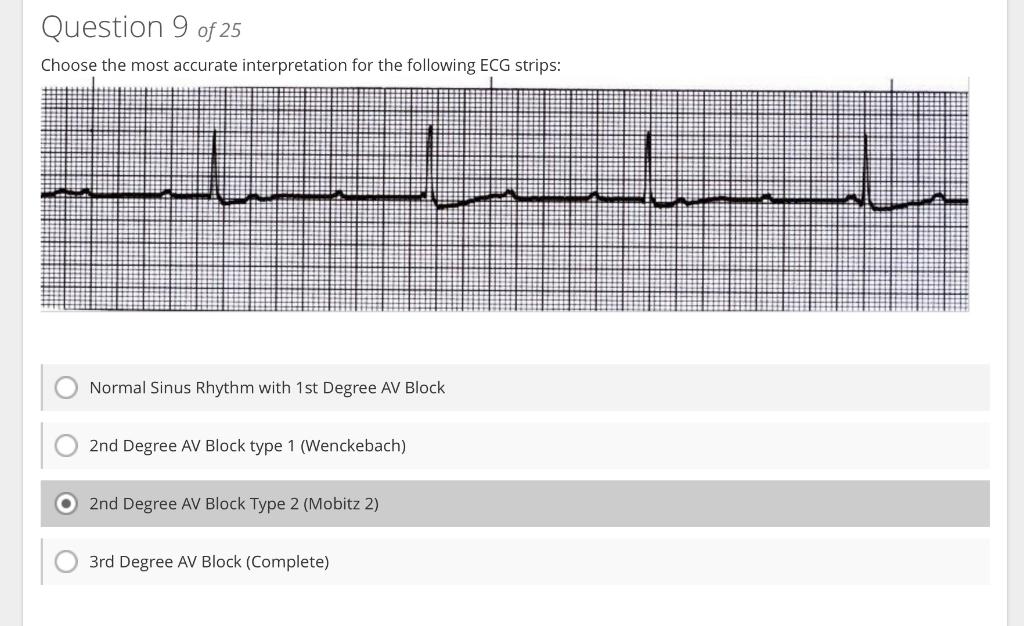 Choose the most accurate interpretation for the following ECG strips:
Normal Sinus Rhythm with 1st Degree AV Block
2nd Degree