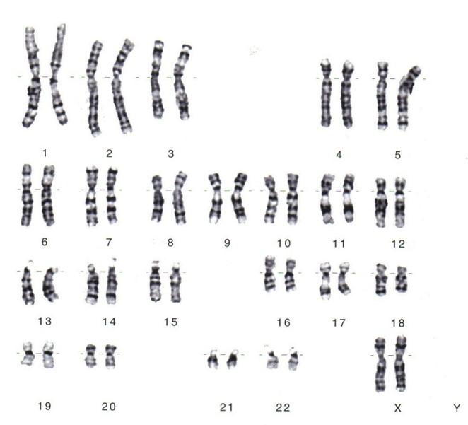 Solved 1. How many chromosomes are present in the Karyotype | Chegg.com