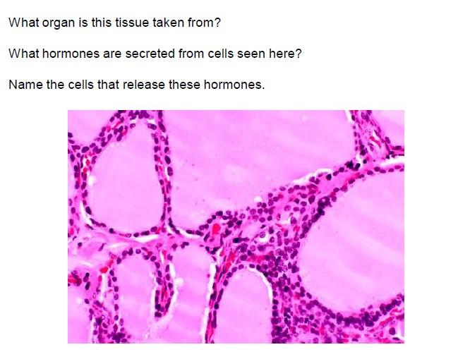 Solved What organ is this tissue taken from? What hormones Biology Diagrams