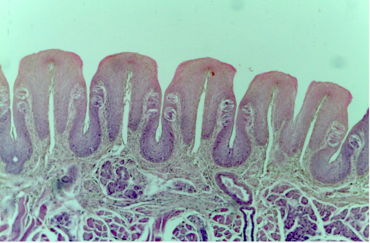 Solved Identify Taste buds, and fungiform papillae on this | Chegg.com