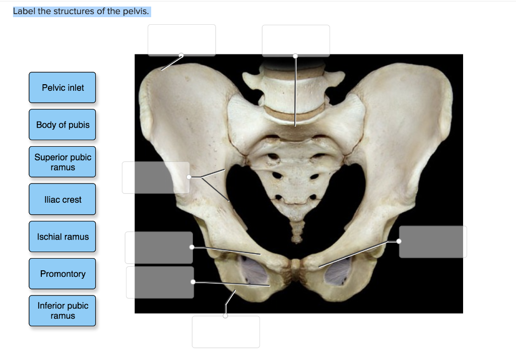 Solved Body of mandible Mandibular notch Ramus of mandible | Chegg.com