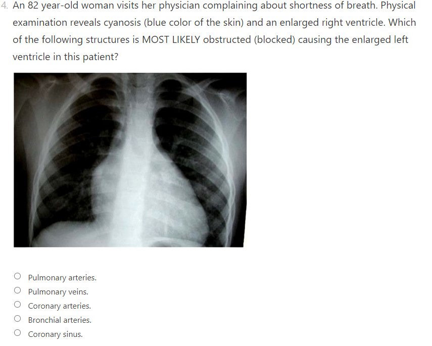 Solved 3. A 59 year-old woman is diagnosed with a parotid | Chegg.com