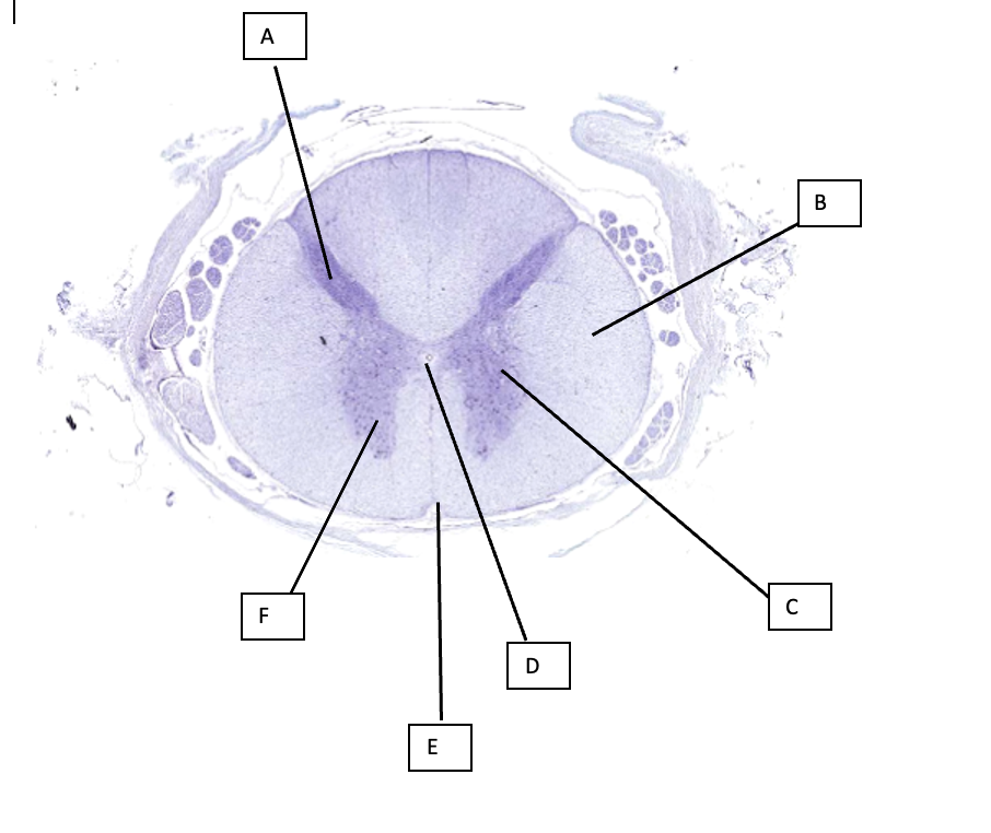 Solved Label the structures on the spinal cord image below | Chegg.com