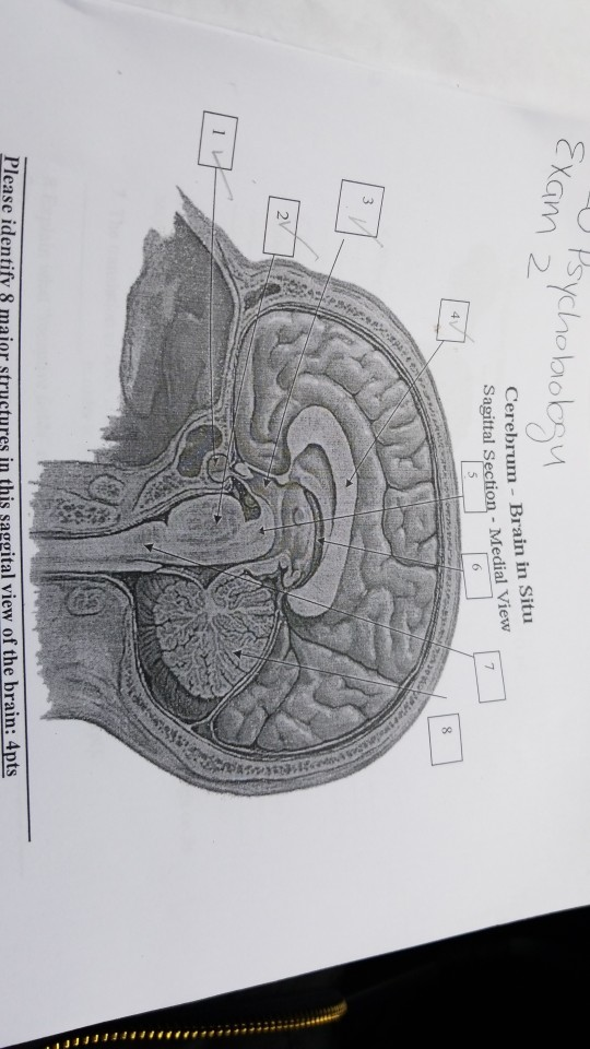 Solved Exam Sychobiology Cerebrum Brain In Situ Sagittal Chegg Com