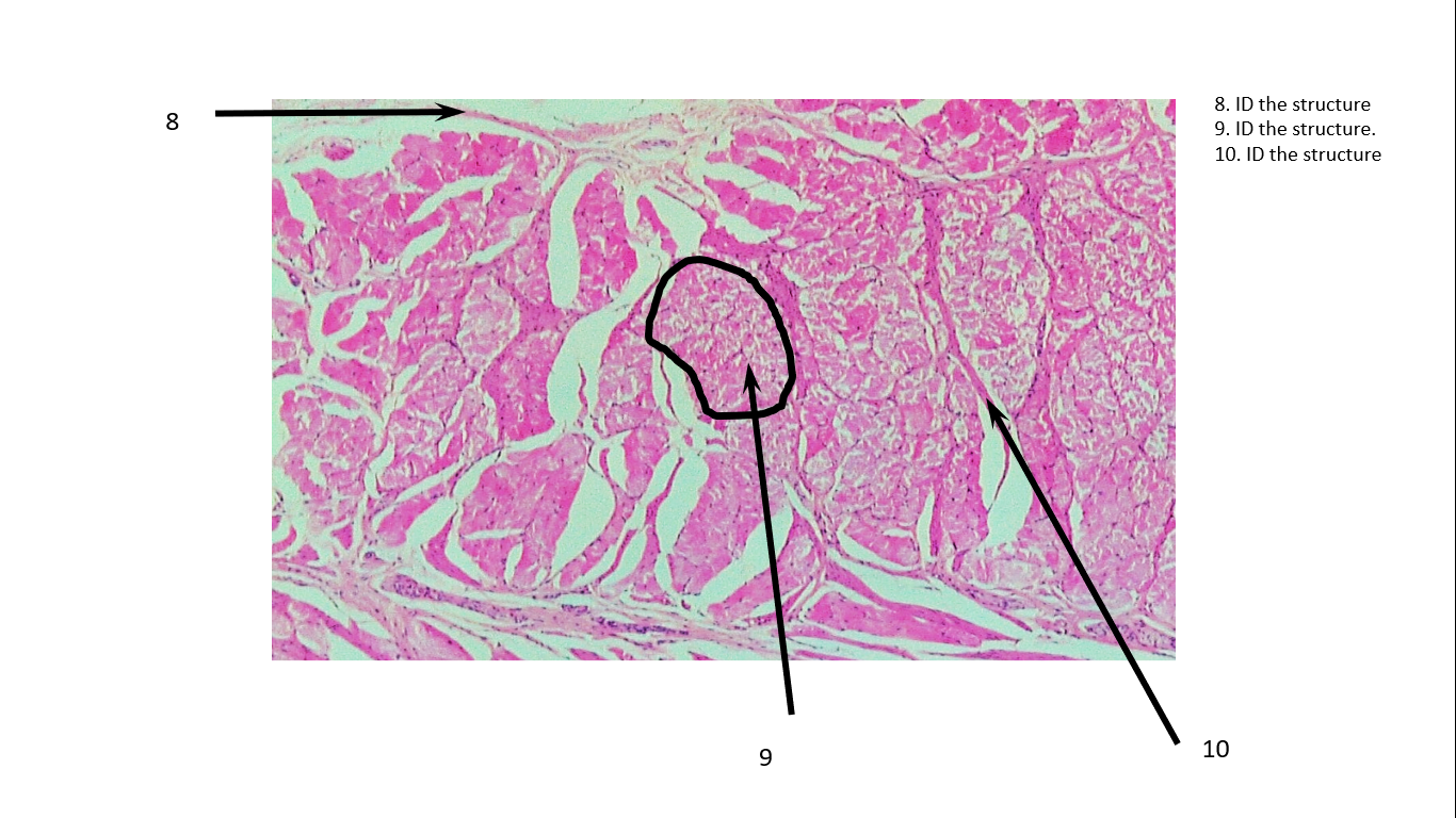 Solved 7. ID. Type of muscle 1. Name the type of | Chegg.com