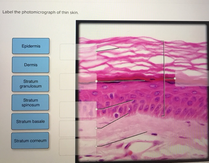 Solved Label the photomicrograph of thin skin. Epidermis | Chegg.com