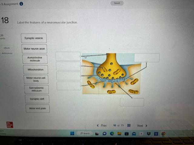 Solved Label the features of a neuromuscular junction. | Chegg.com