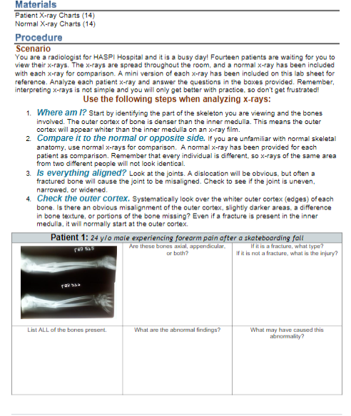 Materials Patient X Ray Charts 14 Normal X Ray Chegg 