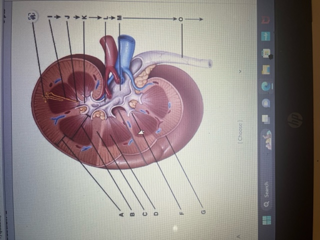 Solved The options are: 1 Renal Medulla 2. Minor | Chegg.com