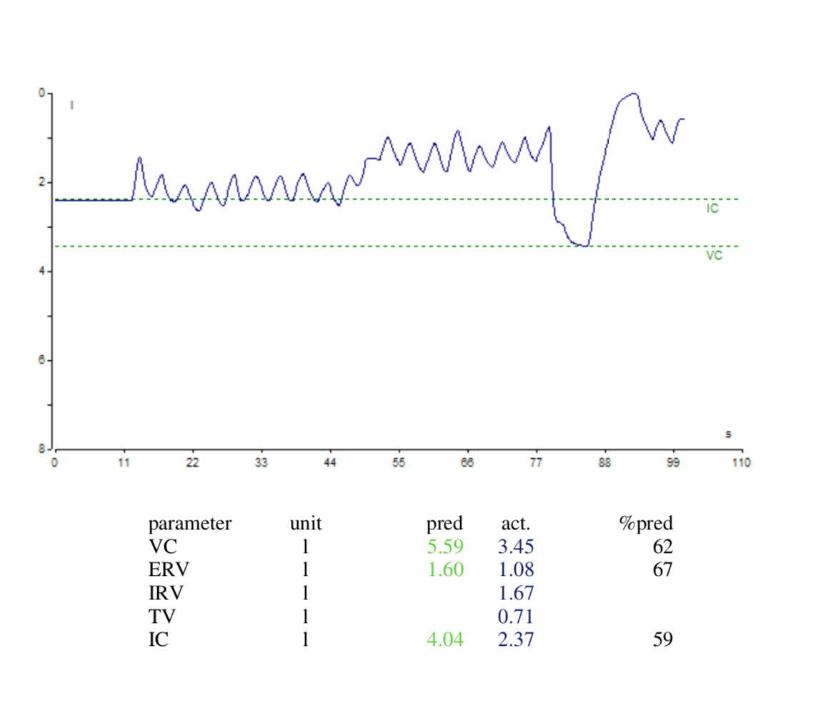 Solved Present a labelled copy of your digital spirometry | Chegg.com