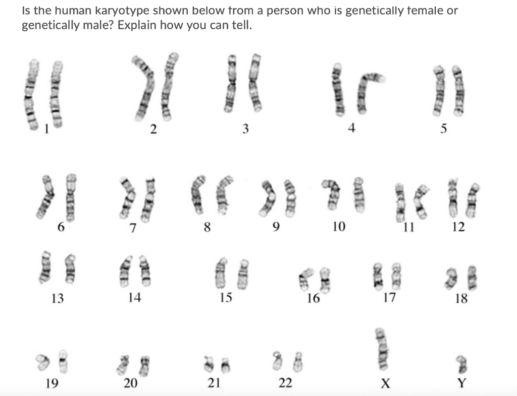 Solved Is the human karyotype shown below from a person who | Chegg.com