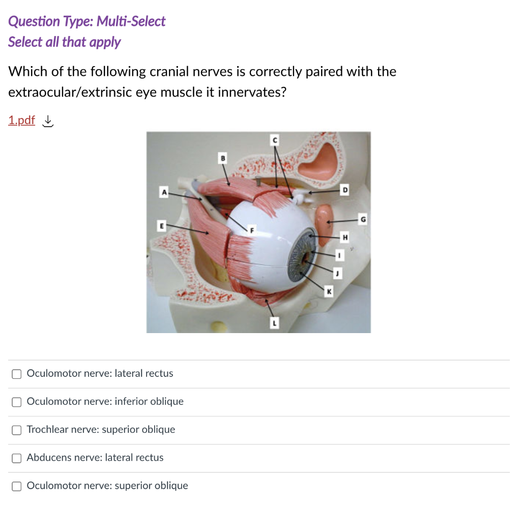 Gedehams skrot tsunamien Solved Question Type: Multi-Select Select all that apply | Chegg.com