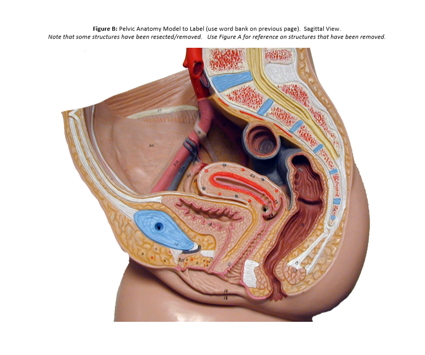 Solved VIII. Lateral/Sagittal view of the Pelvic Region of