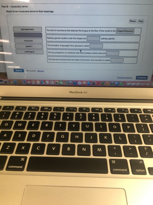Solved: Part B-vocabulary Terms Match These Vocabulary Ter&hellip; | Chegg.com