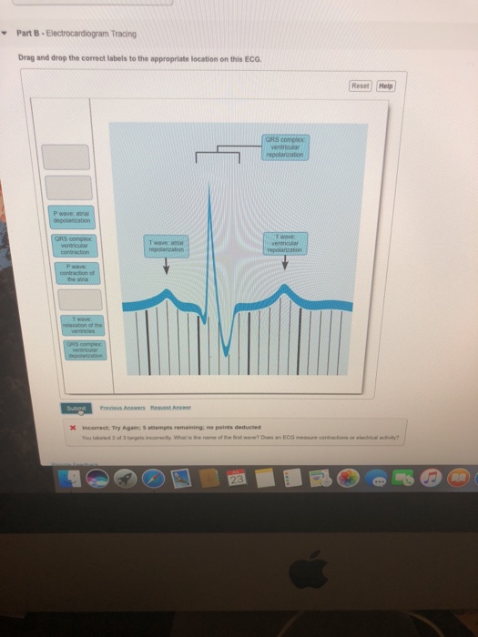 Solved Part B-Electrocardiogram Tracing ? Drag And Drop The | Chegg.com