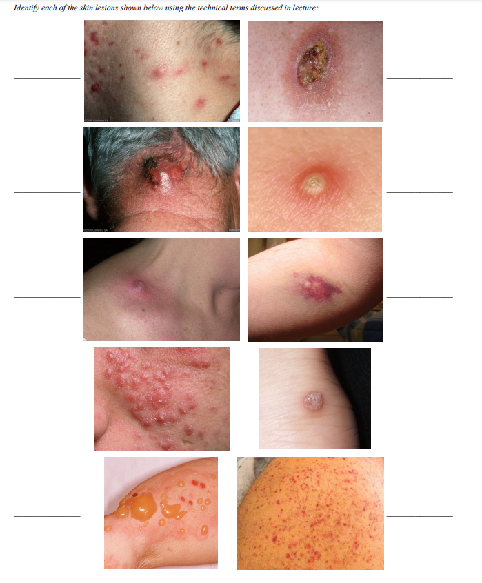 solved-identify-each-of-the-skin-lesions-shown-below-using-chegg