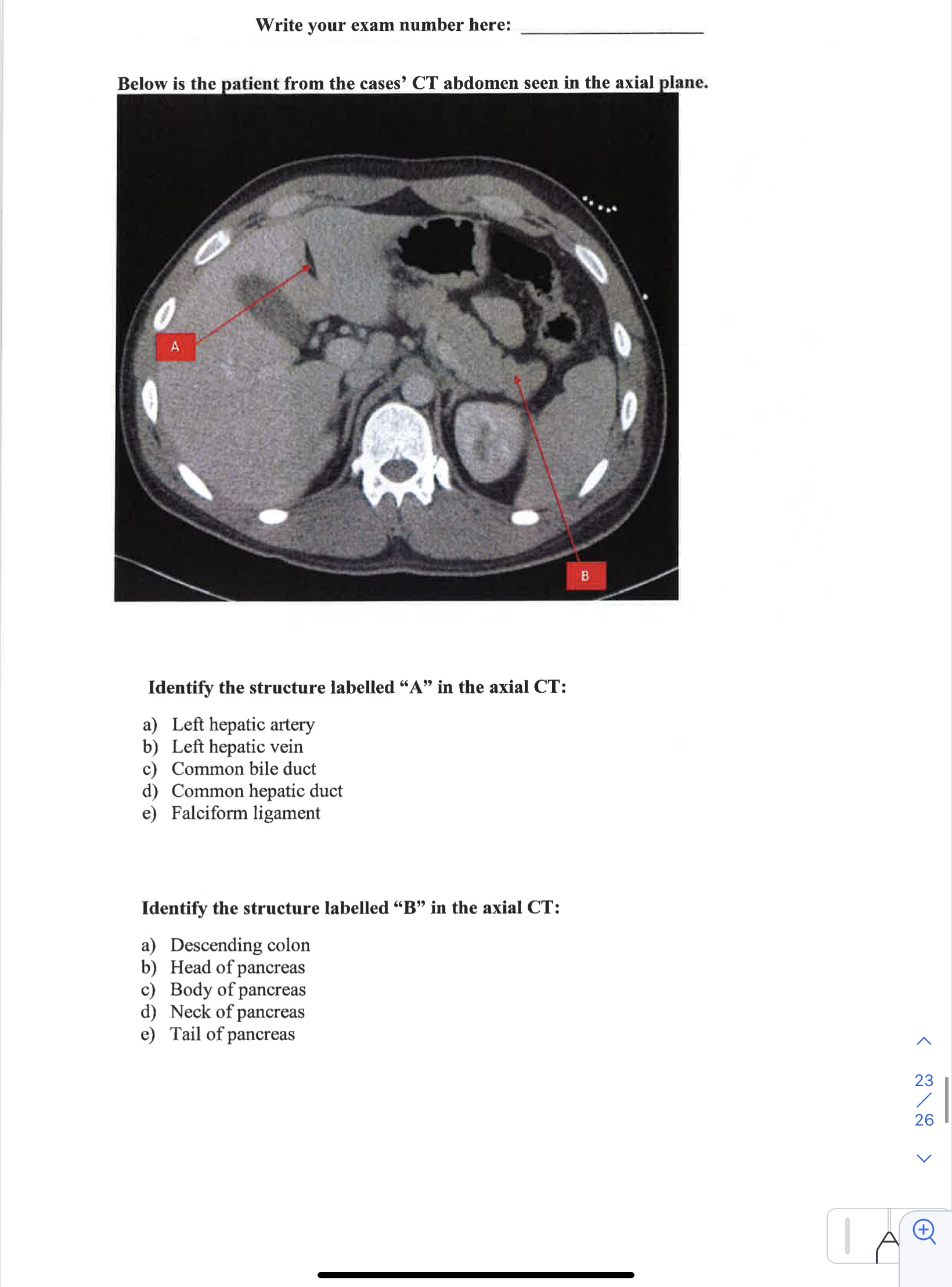 Clinical Case: A 67-year-old woman with a history of | Chegg.com