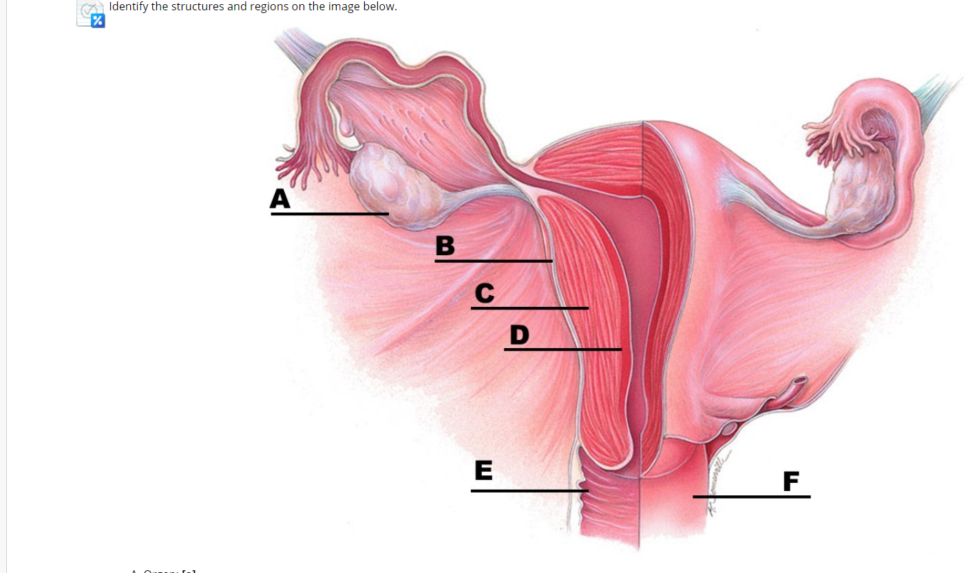 Очаговая железистая гиперплазия эндометрия. Гиперплазия слизистой оболочки матки. Гиперплазия эндометрия. Гиперплазия эндометрия матки что это. Железистая гиперплазия эндометрия.