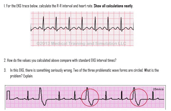 solved-1-for-the-ekg-trace-below-calculate-the-r-r-interval-chegg