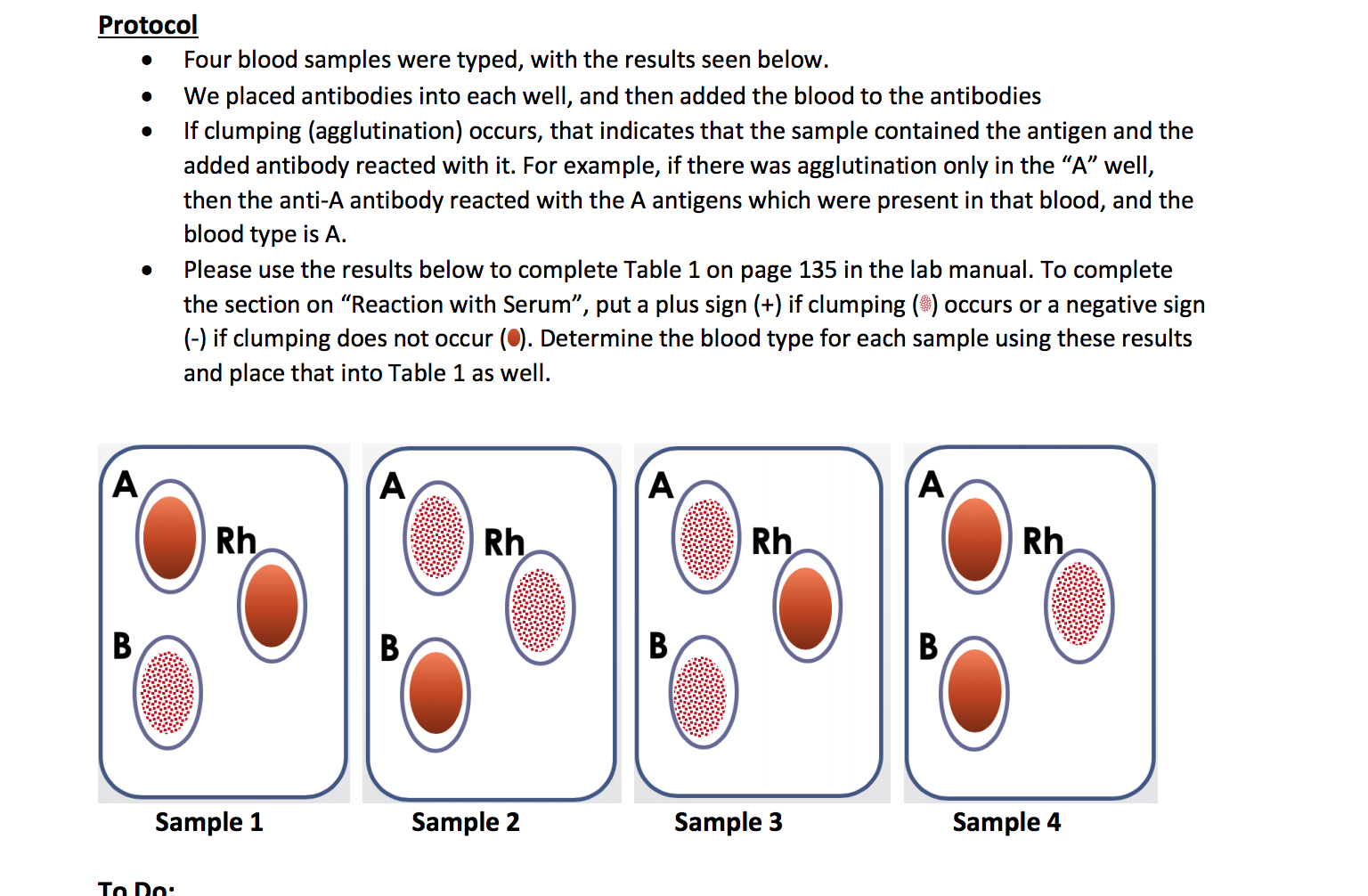 Solved . . Protocol Four blood samples were typed, with the | Chegg.com