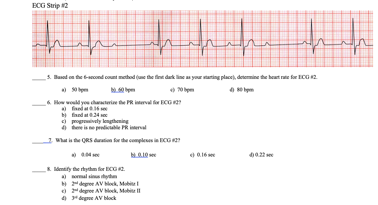 solved-ecg-strip-2-n-5-based-on-the-6-second-count-method-chegg