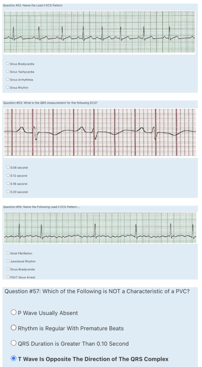 Solved Question #52: Name the Lead II ECG Pattern huhtunut | Chegg.com