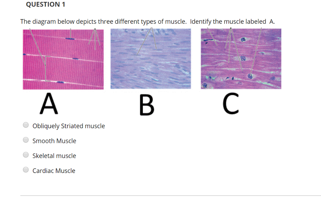 Smooth Muscle Diagram Labeled ~ DIAGRAM