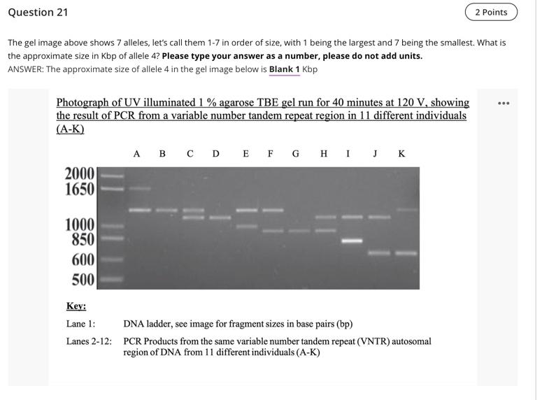 Solved Question 21 The gel image above shows 7 alleles, | Chegg.com