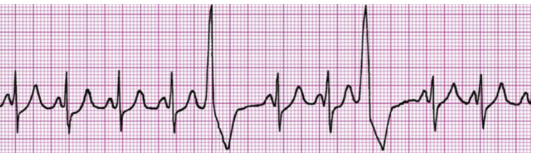 Solved Use the given ECG, then answer the following | Chegg.com