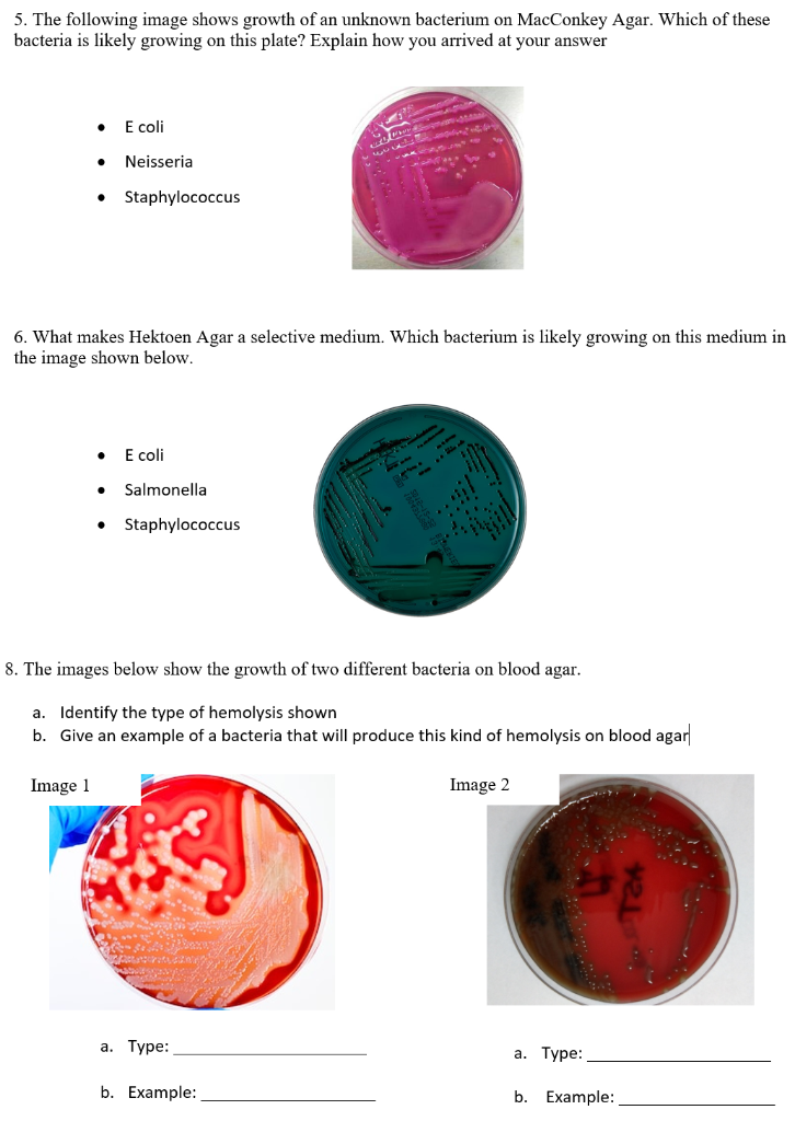 macconkey agar salmonella