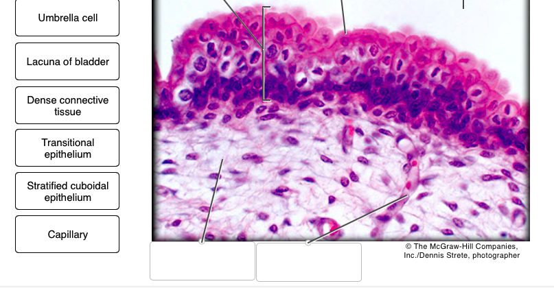 Solved Label the the tissues and structures on the | Chegg.com