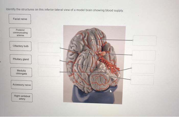 Solved This Inferior Lateral View Of A Model Brain Showin