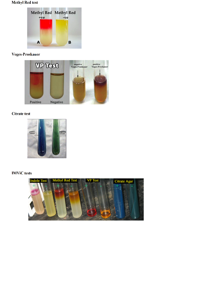 solved-lab-17-imvic-the-imvic-is-a-scrics-of-four-tests-chegg