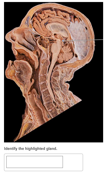 Identify the highlighted gland.
