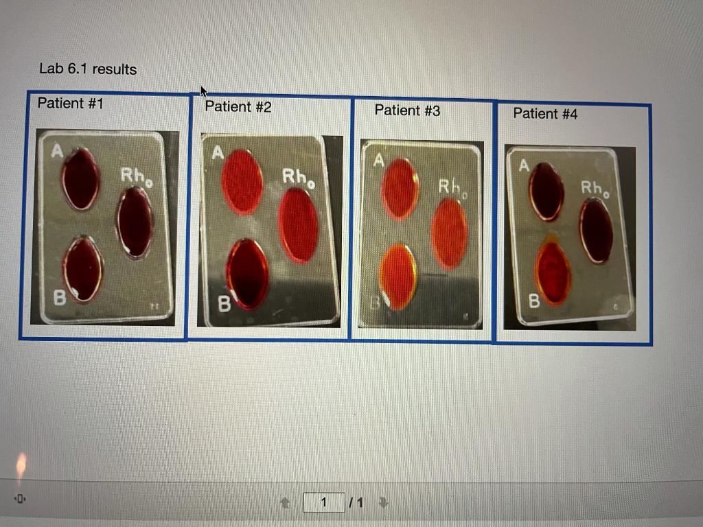 Solved Lab 6.1 results Patient #1 Patient #2 Patient #3 | Chegg.com