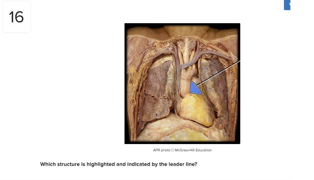 solved-16-apr-photo-mcgraw-hill-education-which-structure-is-chegg