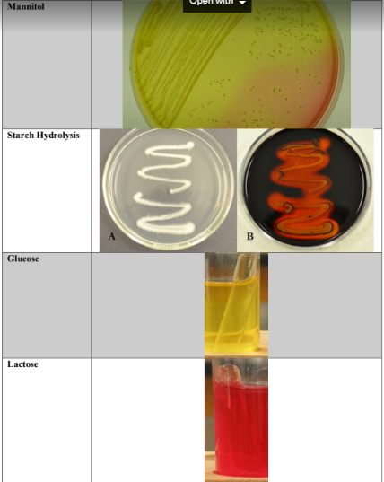 Solved Part 2: Media and Biochemical Tests For Gram Positive | Chegg.com