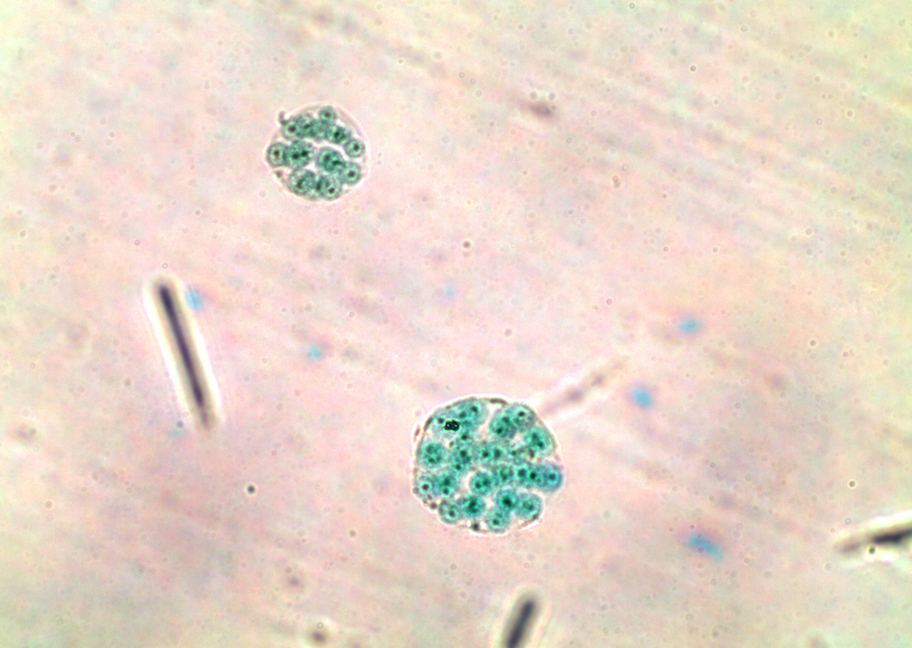 Solved Identify the following microscopic algae use this | Chegg.com