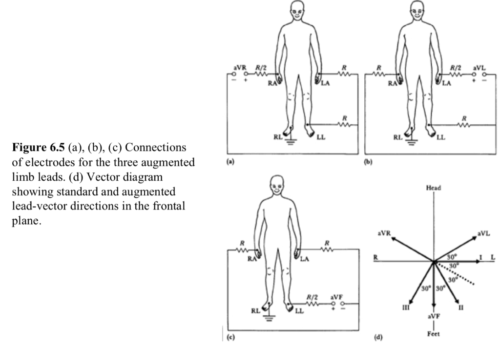 Solved Above Figures show the body electrode connections for