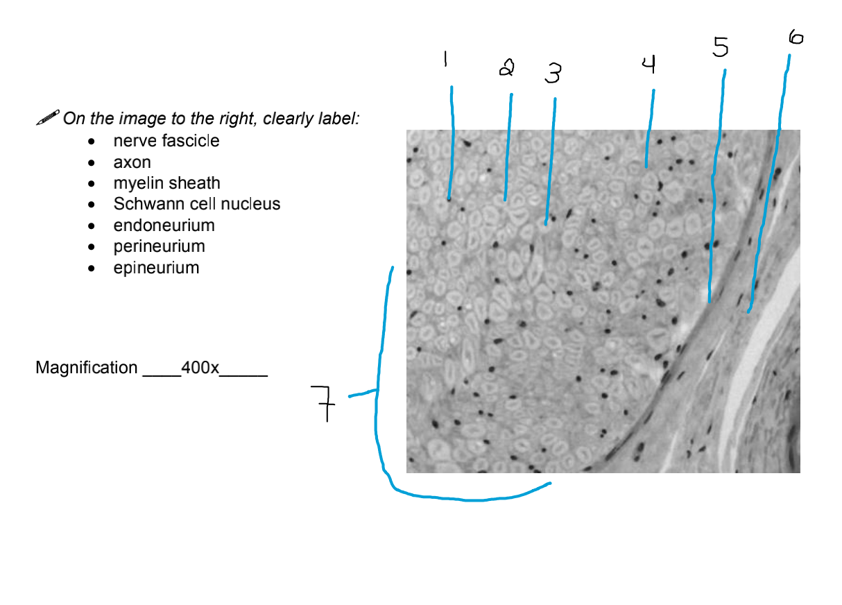 Solved On this slide they distinguish between axons and | Chegg.com