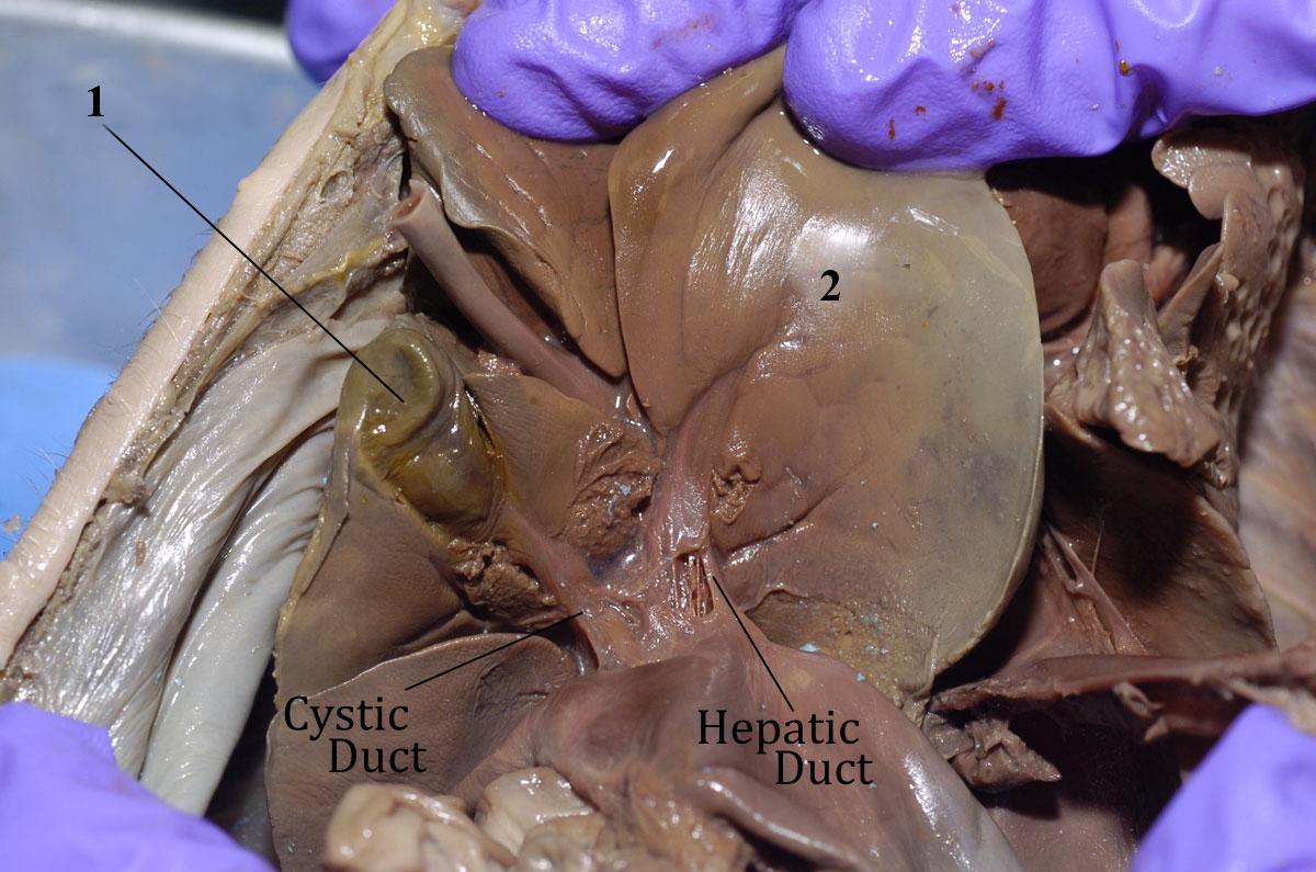 fetal pig gallbladder cystic duct