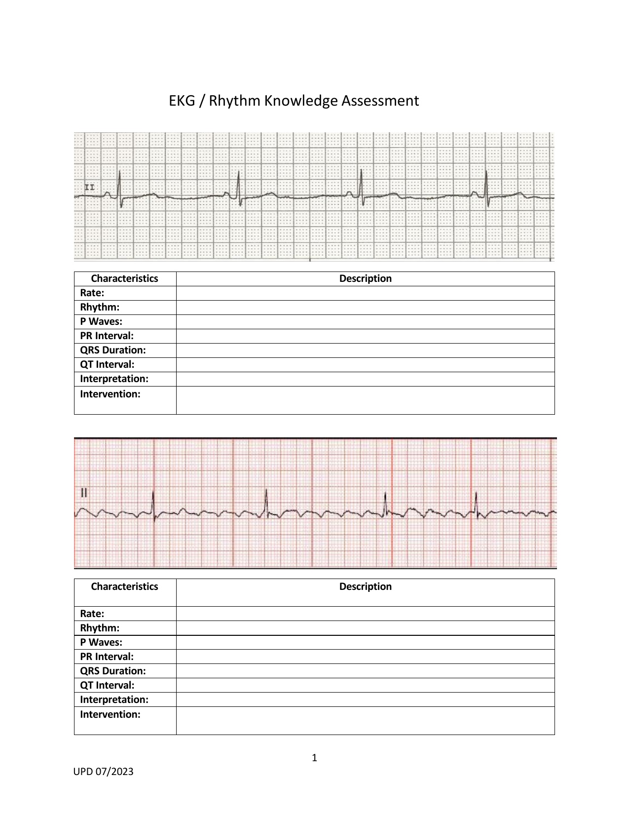 Solved EKG / Rhythm Knowledge Assessment | Chegg.com