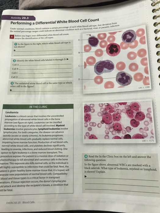Solved Activity 20.3 Performing a Differential White Blood