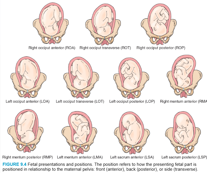 Fetal Positions For Labor Fetal Positions For Birth TSDG
