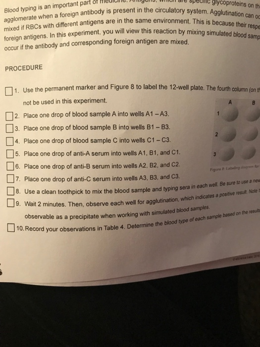 experiment 4 blood typing