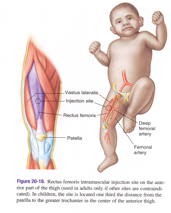 vastus lateralis injection site for children