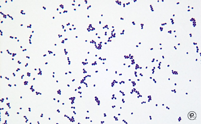 Solved Describe the GRAM NATURE (Colony morphology and | Chegg.com