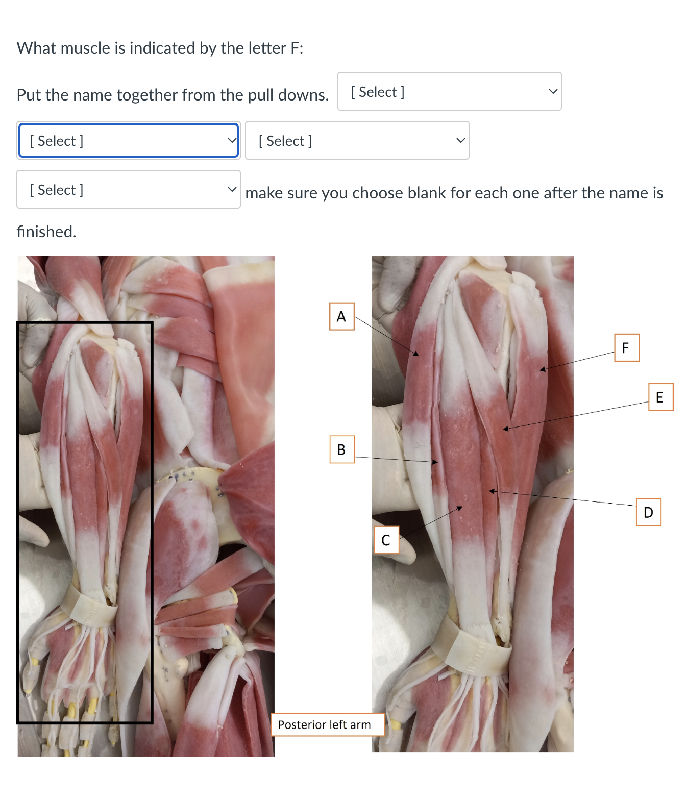 Solved What muscle is indicated by the letter F : Put the | Chegg.com