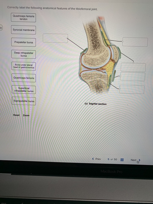 Correctly label the following anatomical features of the tibiofemoral joint.