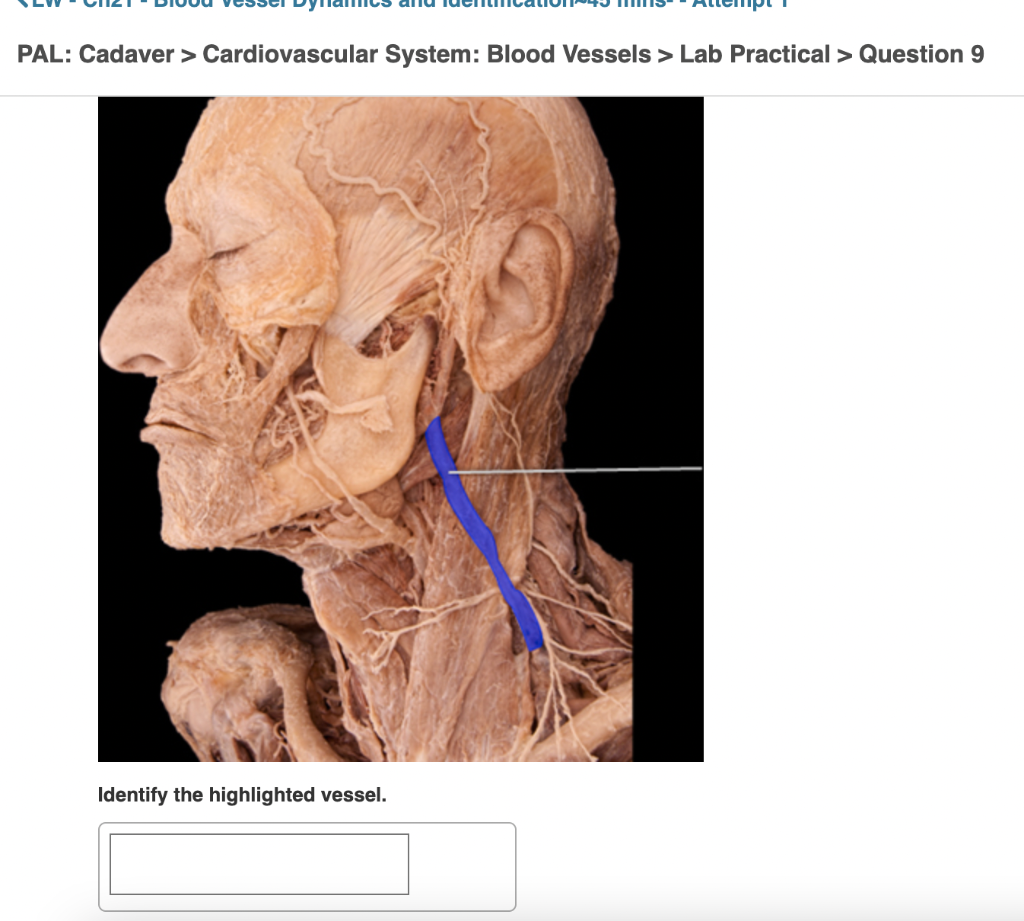 Solved PAL Cadaver > Cardiovascular System Blood Vessels >